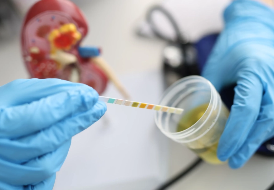 改善腎功能 飲食 改善腎功能 飲食