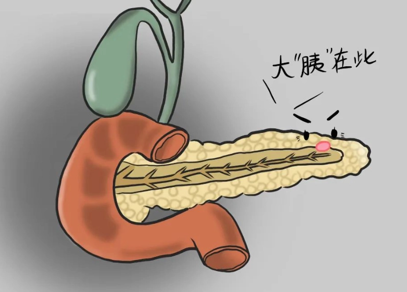 胰臟炎飲食菜單