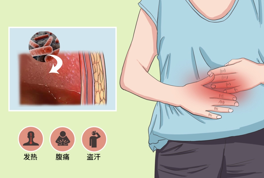 腹膜炎症狀