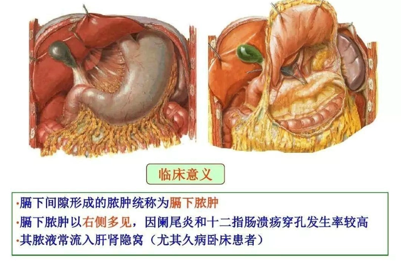 腸沾黏