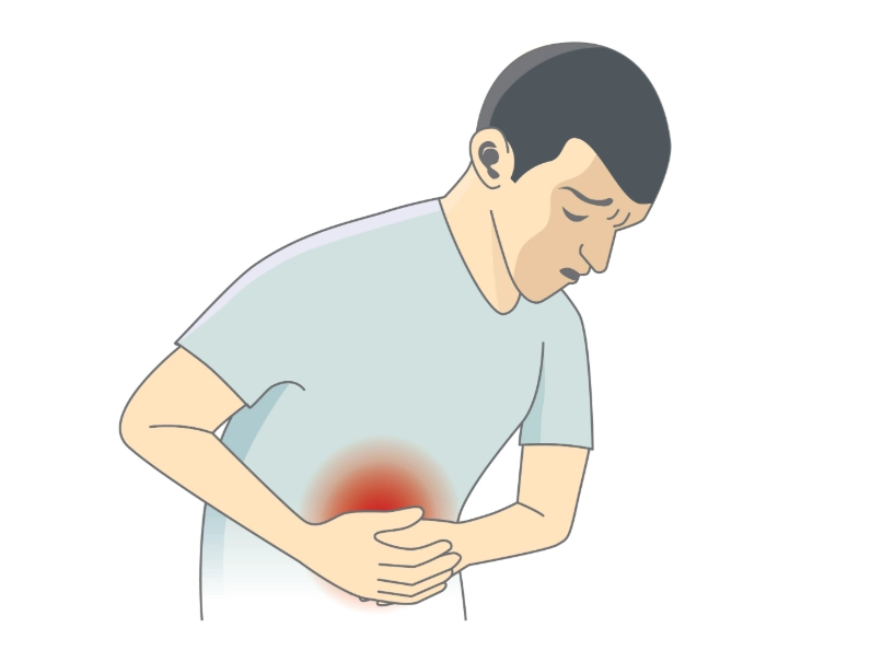 腹膜炎原因